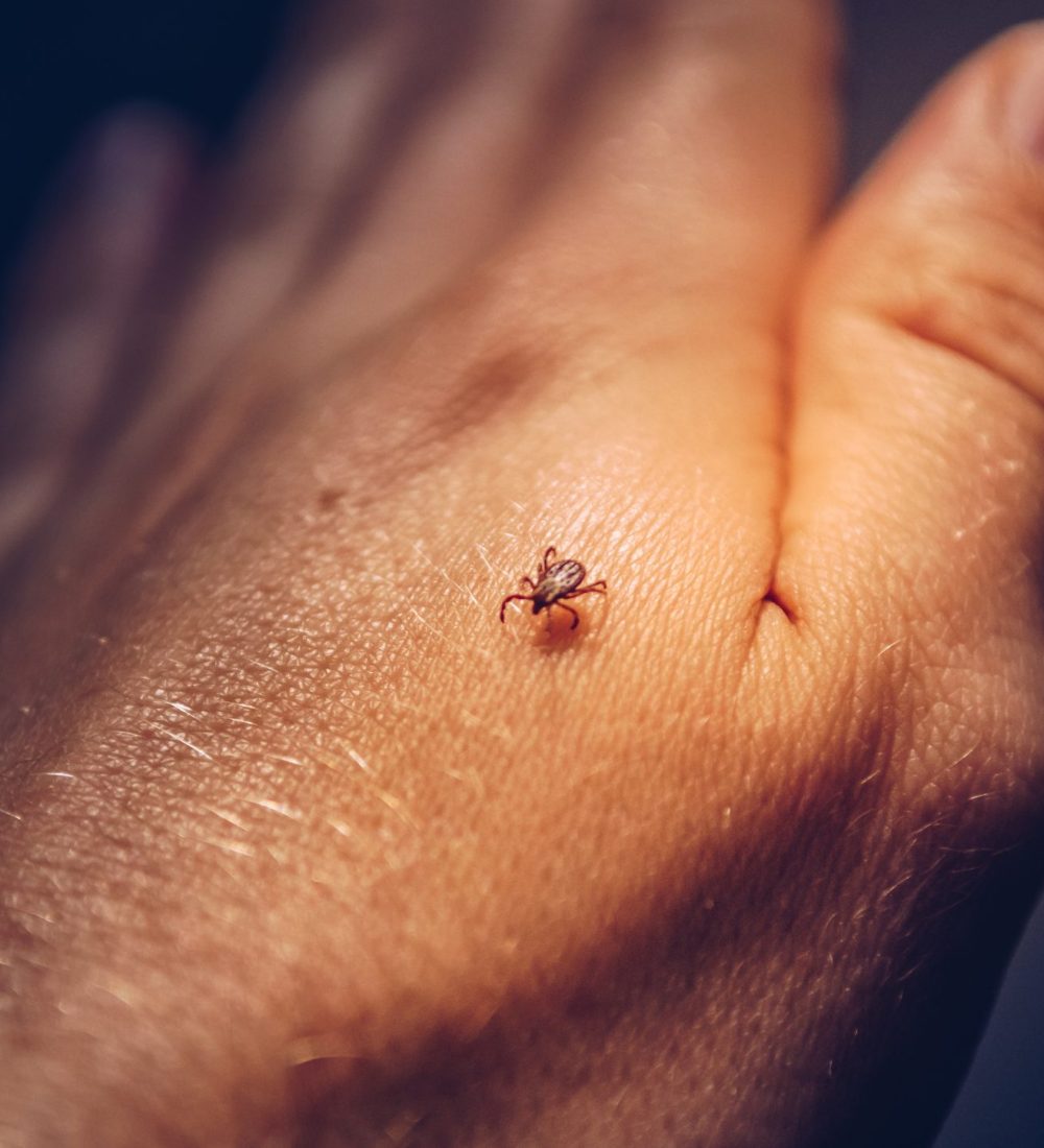 tick-crawling-on-human-hand-2021-08-29-01-00-27-utc